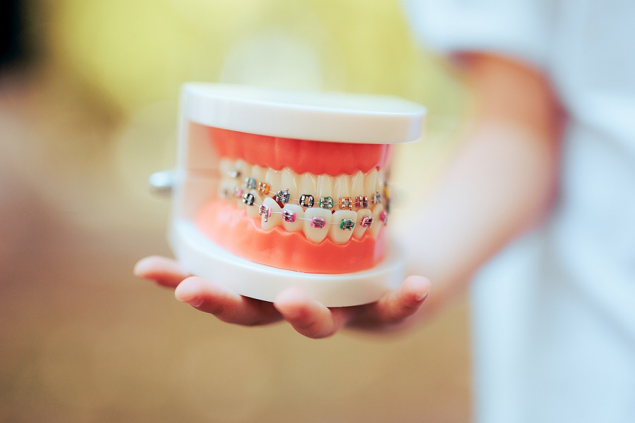 What does Myofunctional Therapy Offer Braces and Orthodontic Appliance Treatment?